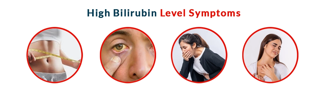 High Bilirubin Level Symptoms